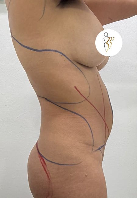 Cirujanos Plásticos en Colombia, Dr. Ronald Ramos, Cirujano Plástico certificado