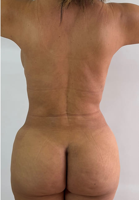Cirujanos Plásticos en Colombia, Dr. Ronald Ramos, Cirujano Plástico certificado