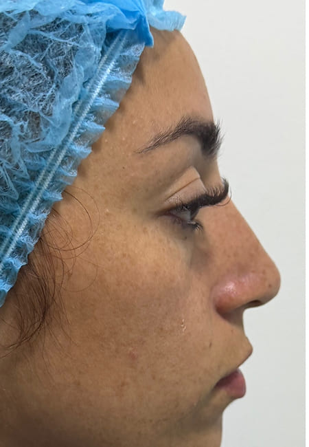 Cirujanos Plásticos en Colombia, Dr. Ronald Ramos, Cirujano Plástico certificado