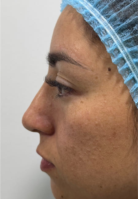 Cirujanos Plásticos en Colombia, Dr. Ronald Ramos, Cirujano Plástico certificado