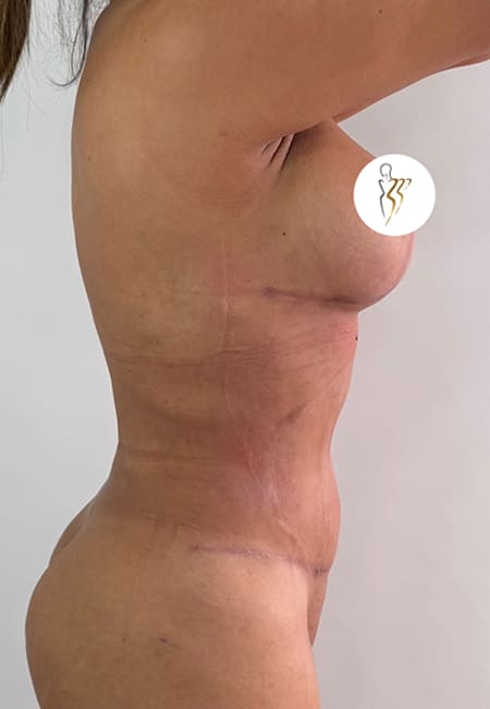 Cirujanos Plásticos en Colombia, Dr. Ronald Ramos, Cirujano Plástico certificado