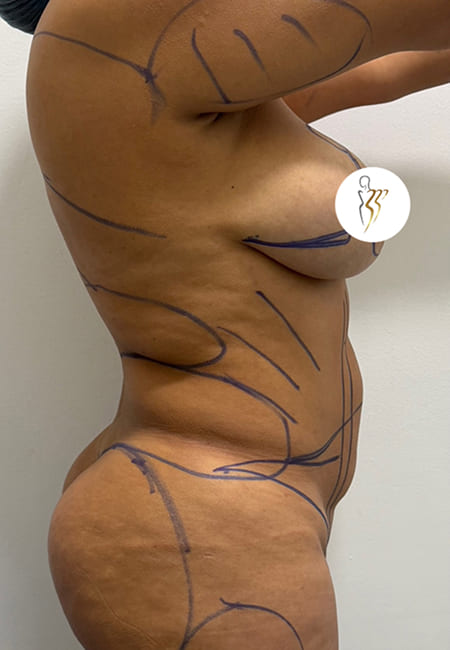 Cirujanos Plásticos en Colombia, Dr. Ronald Ramos, Cirujano Plástico certificado
