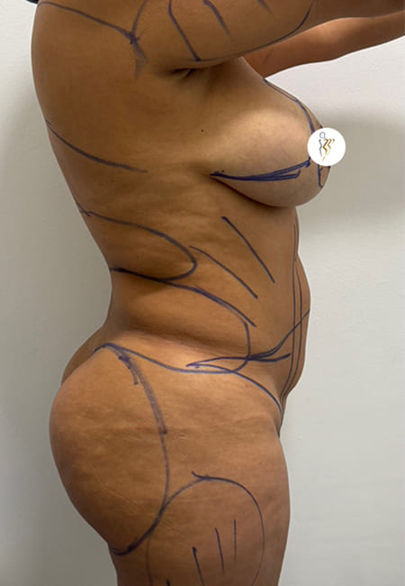 Cirujanos Plásticos en Colombia, Dr. Ronald Ramos, Cirujano Plástico certificado