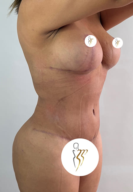 Cirujanos Plásticos en Colombia, Dr. Ronald Ramos, Cirujano Plástico certificado