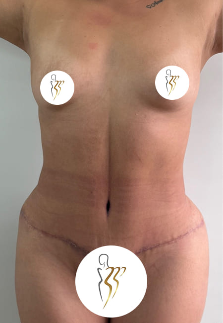 Cirujanos Plásticos en Colombia, Dr. Ronald Ramos, Cirujano Plástico certificado
