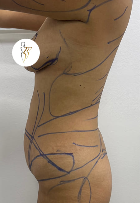 Cirujanos Plásticos en Colombia, Dr. Ronald Ramos, Cirujano Plástico certificado