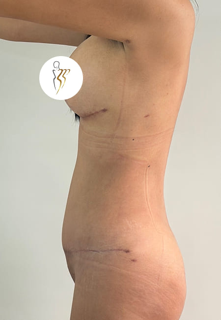 Cirujanos Plásticos en Colombia, Dr. Ronald Ramos, Cirujano Plástico certificado